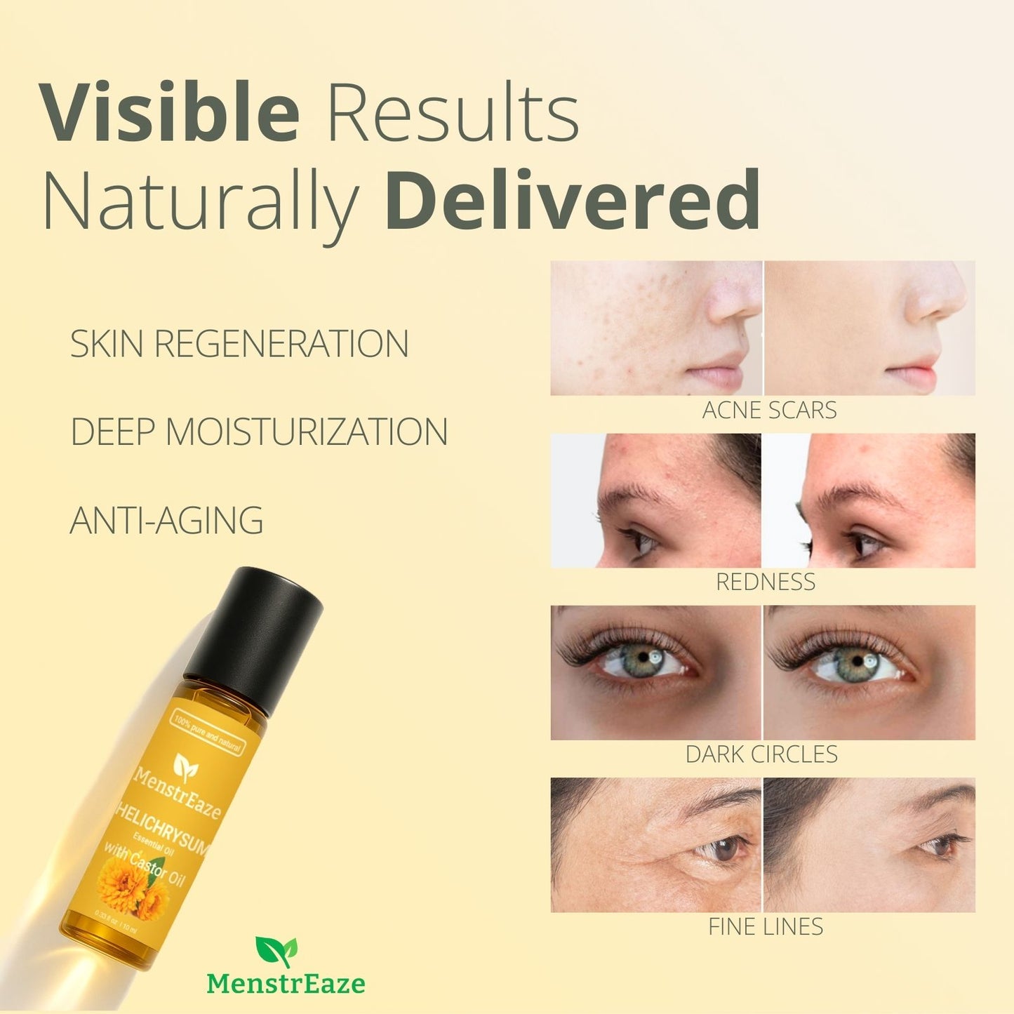 Helichrysum Castor Oil Rollon Before and After