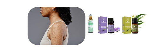 Understanding & How to Get Rid of Arm Acne: Diluted Oils' Role