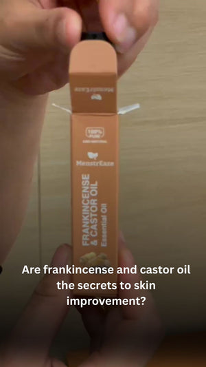 Frankincense and Castor Oil Roller 
